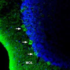 Anti-GPR40/FFAR1 (extracellular) Antibody