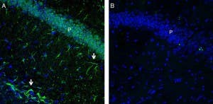 Anti-GPR43/FFAR2 Antibody