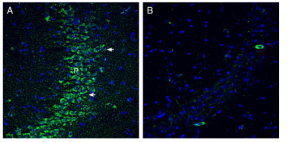 Anti-SLC19A1/RFC1 (extracellular) Antibody