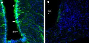 Anti-GABA(A) β2 Receptor Antibody