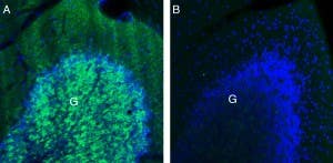 Anti-GABA(A) β3 Receptor Antibody