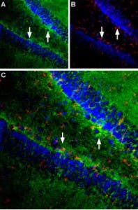Anti-EAAT1 (GLAST) (extracellular) Antibody