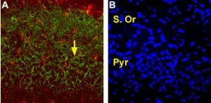 Anti-EAAT2 (GLT-1) (extracellular) Antibody