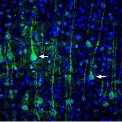 Anti-VGLUT1 Antibody