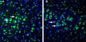 Anti-NETO1 (extracellular) Antibody
