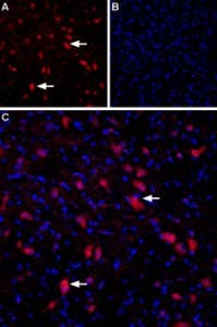 Anti-GRIK4 (KA1) (extracellular) Antibody