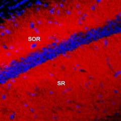Guinea pig Anti-K<sub>V</sub>4.2 Antibody