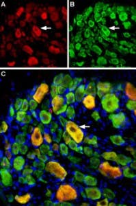 Anti-ASIC3 Antibody