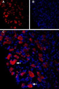 Guinea pig Anti-Ca<sub>V</sub>1.3 (CACNA1D) Antibody
