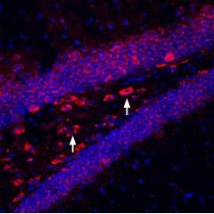Guinea pig Anti-K<sub>ir</sub>6.2 Antibody