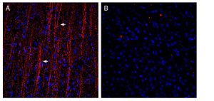 Guinea pig Anti-P2Y12 Receptor (extracellular) Antibody