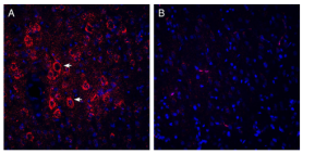 Guinea Pig Anti-VGLUT2 Antibody