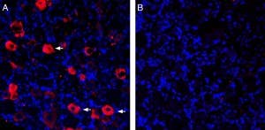 Guinea Pig Anti-P2X3 Antibody