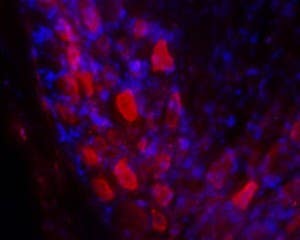 Anti-GALR2 Antibody
