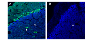 Anti-Glycine Receptor β Antibody