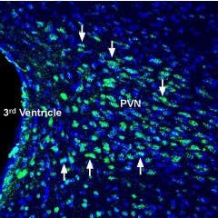 Anti-Glucagon Receptor (extracellular) Antibody