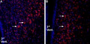 Anti-Ghrelin Receptor (GHSR) (extracellular) Antibody