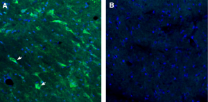 Anti-GPR88 Antibody
