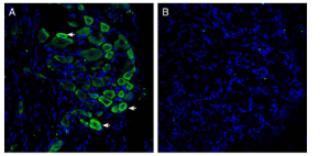 Anti-GPR35 (extracellular) Antibody