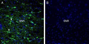 Anti-GPR52 Antibody
