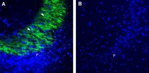 Anti-GPR31 (extracellular) Antibody
