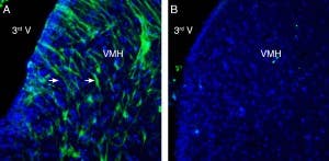 Anti-GPR139 Antibody
