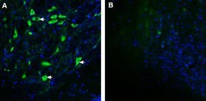 Anti-GPRC5B Antibody