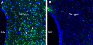 Anti-GPR75 Antibody