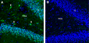GPR75 Blocking Peptide