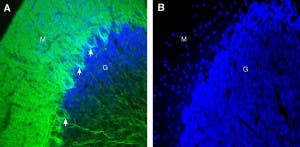Anti-GPR158 Antibody