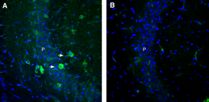 Anti-GPR151 (extracellular) Antibody