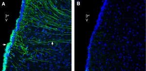 Anti-GPR142 (extracellular) Antibody