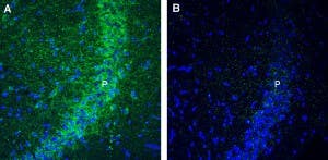 Anti-GPR160 Antibody