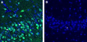 Anti-GPR173 Antibody