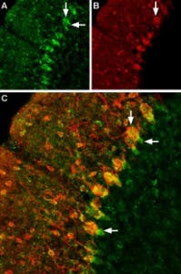 Anti-GABA Transporter 1 (GAT-1) (extracellular) Antibody