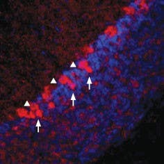 Anti-Vesicular GABA Transporter (VGAT) Antibody