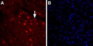 Anti-GlyT2 (SLC6A5) (extracellular) Antibody
