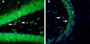 Anti-GLUT2 (SLC2A2)-ATTO Fluor-488 Antibody