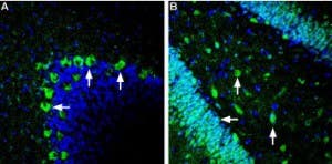 Anti-GLUT2 (SLC2A2) Antibody
