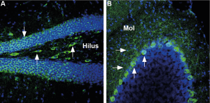 Anti-GLUT3 (extracellular) Antibody