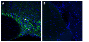 Anti-SMCT1 (SLC5A8) Antibody