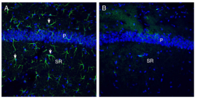 Anti-OTOP1 Antibody