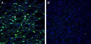 Anti-Histamine H<sub>1 </sub> Receptor/HRH1 (extracellular) Antibody