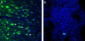 Anti-GPR109A/HCAR2 (extracellular) Antibody