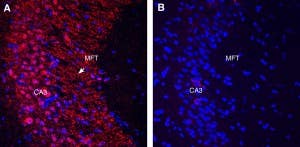 Guinea Pig Anti-Gephyrin Antibody