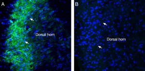 Anti-Sigma-1 Receptor Antibody