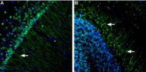 Anti-Presenilin-1 Antibody