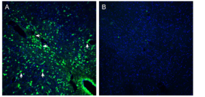 Anti-Presenilin-2 Antibody