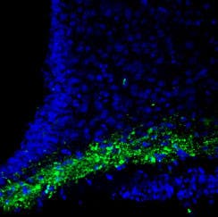 Anti-CASK Antibody