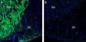 Anti-Neurofascin Antibody